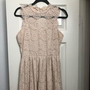 Lace xhileration dress
